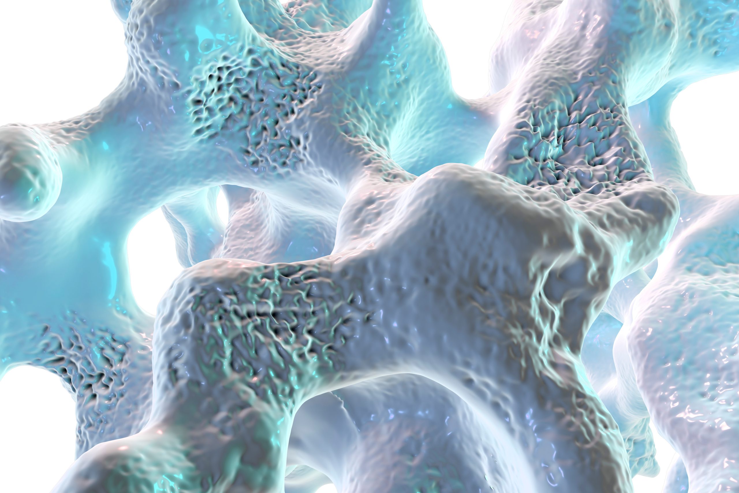 Spongy bone tissue affected by osteoporosis, 3D illustration